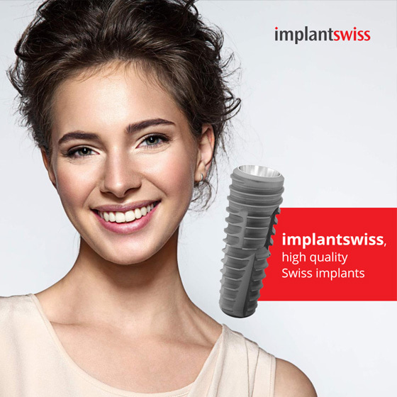 design web site prezentare implant dentar implant swiss 21vision agentie publicitate oradea (3)